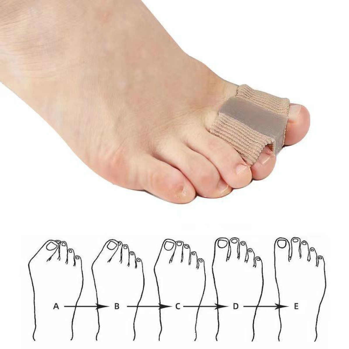 Double-hole Toe Separator Thumb Valgus Orthosis, Size: L